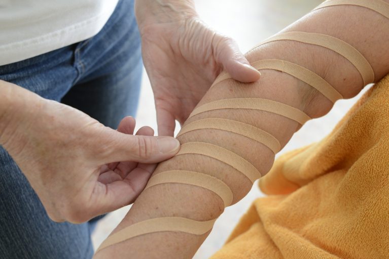 Arm behandeling